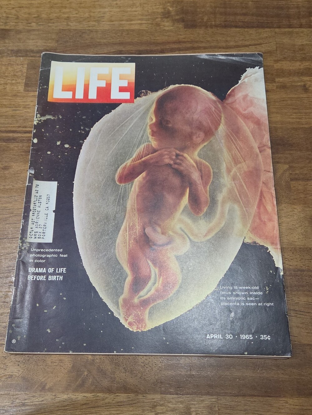 LIFE Magazine Drama Of Life Before Birth April 30, 1965